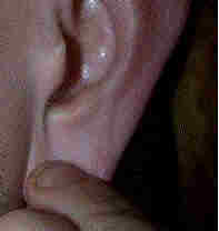 Photo: 2  -  Tug on the earlobe.